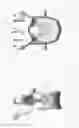 Fig. 09 - Circumferential vertebral column fixation system