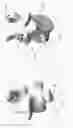 Fig. 18 - Circumferential vertebral column fixation system