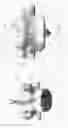 Fig. 20 - Circumferential vertebral column fixation system