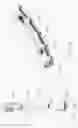 Fig. 21 - Circumferential vertebral column fixation system