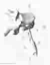Fig. 42 - Circumferential vertebral column fixation system