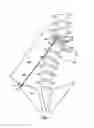 Fig. 02 - Device and method for treatment of spinal deformity