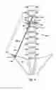 Fig. 03 - Device and method for treatment of spinal deformity