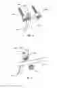Fig. 04 - Device and method for treatment of spinal deformity