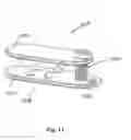 Fig. 10 - Device and method for treatment of spinal deformity