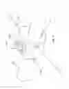 Fig. 13 - Device and method for treatment of spinal deformity