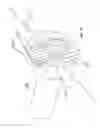 Fig. 14 - Device and method for treatment of spinal deformity