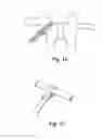 Fig. 15 - Device and method for treatment of spinal deformity