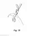 Fig. 16 - Device and method for treatment of spinal deformity