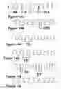 Fig. 10 - Flexible spine components