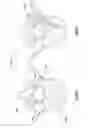 Fig. 08 - Composite material spinal implant