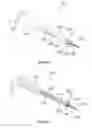 Fig. 50 - Composite material spinal implant