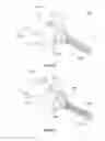 Fig. 52 - Composite material spinal implant