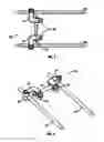 Fig. 02 - Interspinous ligament transverse connector