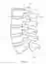 Fig. 02 - Methods and apparatus for stabilizing bone