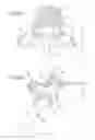Fig. 03 - Methods and apparatus for stabilizing bone