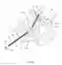 Fig. 07 - Methods and apparatus for stabilizing bone