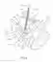 Fig. 08 - Methods and apparatus for stabilizing bone