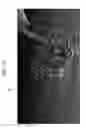 Fig. 17 - Implant positioning devices and methods