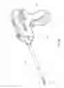 Fig. 07 - Anatomical location markers and methods of use in positioning sheet-like materials during surgery