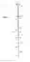 Fig. 04 - Methods of filling bone using bone cement mixing and delivery devices