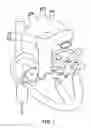 Fig. 04 - Cryogenic balloon device with electroporation treatment region