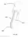Fig. 10 - Attachment for Electrosurgical System
