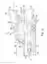Fig. 11 - Simultaneous I-beam and spring driven cam jaw closure mechanism
