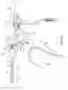 Fig. 20 - Simultaneous I-beam and spring driven cam jaw closure mechanism