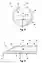 Fig. 05 - Apparatus and method for treating a neuromuscular defect