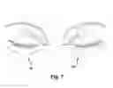 Fig. 07 - Apparatus and method for treating a neuromuscular defect
