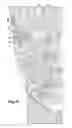 Fig. 08 - Apparatus and method for treating a neuromuscular defect