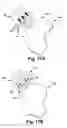 Fig. 11 - Apparatus and method for treating a neuromuscular defect