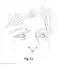 Fig. 12 - Apparatus and method for treating a neuromuscular defect