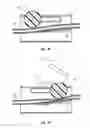 Fig. 13 - ELECTROSURGICAL INSTRUMENT WITH SELECTIVE CONTROL OF ELECTRODE ACTIVITY