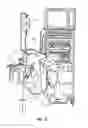 Fig. 14 - ELECTROSURGICAL INSTRUMENT WITH SELECTIVE CONTROL OF ELECTRODE ACTIVITY