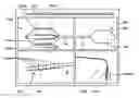 Fig. 01 - Method and apparatus for percutaneous epicardial ablation of cardiac ganglionated plexi without myocardial injury
