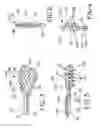 Fig. 03 - Method and apparatus for percutaneous epicardial ablation of cardiac ganglionated plexi without myocardial injury