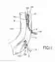 Fig. 06 - Method and apparatus for percutaneous epicardial ablation of cardiac ganglionated plexi without myocardial injury