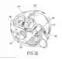 Fig. 07 - Method and apparatus for percutaneous epicardial ablation of cardiac ganglionated plexi without myocardial injury