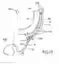 Fig. 08 - Method and apparatus for percutaneous epicardial ablation of cardiac ganglionated plexi without myocardial injury