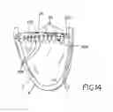 Fig. 09 - Method and apparatus for percutaneous epicardial ablation of cardiac ganglionated plexi without myocardial injury