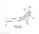 Fig. 10 - Method and apparatus for percutaneous epicardial ablation of cardiac ganglionated plexi without myocardial injury