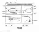 Fig. 14 - Method and apparatus for percutaneous epicardial ablation of cardiac ganglionated plexi without myocardial injury