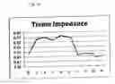Fig. 07 - METHOD AND APPARATUS FOR REMODELING/PROFILING A TISSUE LUMEN, PARTICULARLY IN THE URETHRAL LUMEN IN THE PROSTATE GLAND