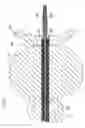 Fig. 08 - METHOD AND APPARATUS FOR REMODELING/PROFILING A TISSUE LUMEN, PARTICULARLY IN THE URETHRAL LUMEN IN THE PROSTATE GLAND