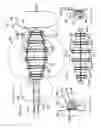 Fig. 12 - METHOD AND APPARATUS FOR REMODELING/PROFILING A TISSUE LUMEN, PARTICULARLY IN THE URETHRAL LUMEN IN THE PROSTATE GLAND
