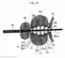 Fig. 13 - METHOD AND APPARATUS FOR REMODELING/PROFILING A TISSUE LUMEN, PARTICULARLY IN THE URETHRAL LUMEN IN THE PROSTATE GLAND
