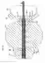 Fig. 24 - METHOD AND APPARATUS FOR REMODELING/PROFILING A TISSUE LUMEN, PARTICULARLY IN THE URETHRAL LUMEN IN THE PROSTATE GLAND