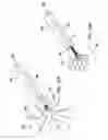 Fig. 10 - Systems and methods for spherical ablations